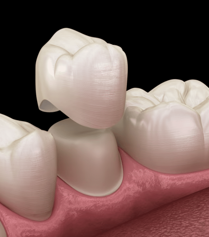 capsula dentale